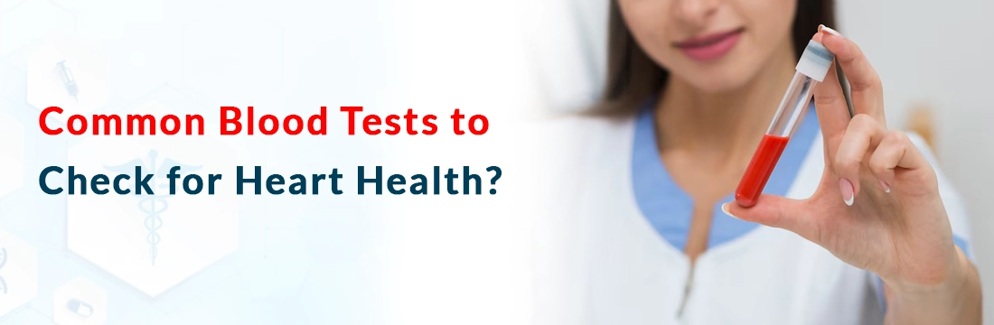  Common Blood Tests to Check for Heart Health?